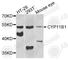 Cytochrome P450 Family 11 Subfamily B Member 1 antibody, A7664, ABclonal Technology, Western Blot image 