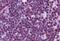 Cyclin Dependent Kinase Inhibitor 1B antibody, NB100-2816, Novus Biologicals, Immunohistochemistry paraffin image 