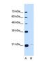 Transmembrane P24 Trafficking Protein 3 antibody, NBP1-69575, Novus Biologicals, Western Blot image 