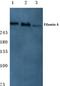 Filamin A antibody, AP06123PU-N, Origene, Western Blot image 