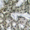 Heat Shock Transcription Factor 1 antibody, LS-C336004, Lifespan Biosciences, Immunohistochemistry paraffin image 