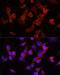 Alpha-1-antitrypsin antibody, LS-C747582, Lifespan Biosciences, Immunofluorescence image 