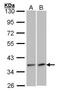 Vascular Endothelial Growth Factor D antibody, PA5-27276, Invitrogen Antibodies, Western Blot image 