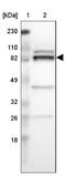 Ribosomal Protein S6 Kinase A3 antibody, NBP1-85552, Novus Biologicals, Western Blot image 