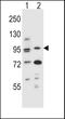 Aryl Hydrocarbon Receptor antibody, LS-C156174, Lifespan Biosciences, Western Blot image 