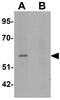 Estrogen Related Receptor Beta antibody, GTX31852, GeneTex, Western Blot image 