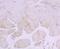 Exportin 1 antibody, NBP2-75448, Novus Biologicals, Immunohistochemistry paraffin image 