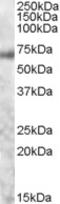 MYB Proto-Oncogene, Transcription Factor antibody, TA302544, Origene, Western Blot image 