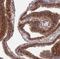 SEPT9 antibody, NBP2-13294, Novus Biologicals, Immunohistochemistry paraffin image 
