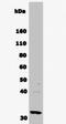 SRY-Box 2 antibody, NB110-79875, Novus Biologicals, Western Blot image 