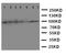ADAM Metallopeptidase With Thrombospondin Type 1 Motif 1 antibody, LS-C313504, Lifespan Biosciences, Western Blot image 