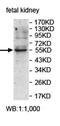 Zinc Finger Protein 320 antibody, orb78070, Biorbyt, Western Blot image 