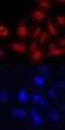 T-Box 18 antibody, MAB63371, R&D Systems, Immunofluorescence image 