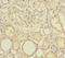 Solute Carrier Family 39 Member 7 antibody, LS-C676514, Lifespan Biosciences, Immunohistochemistry paraffin image 