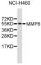 Matrix Metallopeptidase 8 antibody, STJ24591, St John