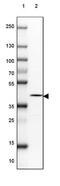 Inositol-Trisphosphate 3-Kinase A antibody, NBP1-81590, Novus Biologicals, Western Blot image 