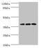 DnaJ Heat Shock Protein Family (Hsp40) Member B5 antibody, orb350433, Biorbyt, Western Blot image 