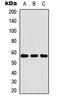 Keratin 4 antibody, LS-C354341, Lifespan Biosciences, Western Blot image 
