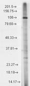 Transient Receptor Potential Cation Channel Subfamily C Member 7 antibody, NBP1-48318, Novus Biologicals, Western Blot image 