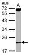 Translation Machinery Associated 16 Homolog antibody, NBP2-16505, Novus Biologicals, Western Blot image 