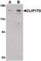 CAP-Gly Domain Containing Linker Protein 1 antibody, PA5-20545, Invitrogen Antibodies, Western Blot image 
