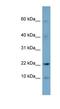 Developmental Pluripotency Associated 5 antibody, NBP1-52919, Novus Biologicals, Western Blot image 