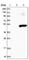 TRNA Methyltransferase 10B antibody, HPA021800, Atlas Antibodies, Western Blot image 