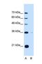 Torsin Family 1 Member B antibody, NBP1-69580, Novus Biologicals, Western Blot image 