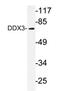 DEAD-Box Helicase 3 X-Linked antibody, AP20221PU-N, Origene, Western Blot image 