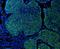 Keratin 5 antibody, M00398-6, Boster Biological Technology, Immunofluorescence image 