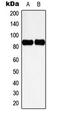 Cortactin antibody, GTX32326, GeneTex, Western Blot image 