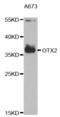 Orthodenticle Homeobox 2 antibody, abx004195, Abbexa, Western Blot image 