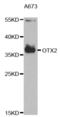 Orthodenticle Homeobox 2 antibody, abx004195, Abbexa, Western Blot image 