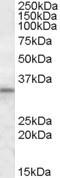 HCLS1 Associated Protein X-1 antibody, EB09160, Everest Biotech, Western Blot image 