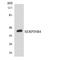 Serpin B4 antibody, LS-C200656, Lifespan Biosciences, Western Blot image 