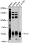 Paternally Expressed 10 antibody, GTX64752, GeneTex, Western Blot image 