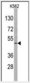 Repulsive Guidance Molecule BMP Co-Receptor B antibody, MBS9216959, MyBioSource, Western Blot image 