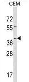 RAD52 Homolog, DNA Repair Protein antibody, LS-C162413, Lifespan Biosciences, Western Blot image 