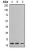 Gastric Inhibitory Polypeptide antibody, LS-B14584, Lifespan Biosciences, Western Blot image 