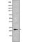 Interferon Alpha 10 antibody, abx216150, Abbexa, Western Blot image 