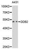 Damage Specific DNA Binding Protein 2 antibody, A1848, ABclonal Technology, Western Blot image 