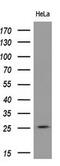 Rho-related GTP-binding protein Rho6 antibody, GTX83709, GeneTex, Western Blot image 