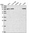 Phosphoinositide-3-Kinase Regulatory Subunit 5 antibody, PA5-65723, Invitrogen Antibodies, Western Blot image 