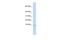 Ubiquinol-Cytochrome C Reductase, Complex III Subunit X antibody, A12320, Boster Biological Technology, Western Blot image 