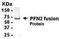 Profilin 2 antibody, PA1-20870, Invitrogen Antibodies, Western Blot image 