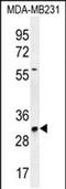 TNF Alpha Induced Protein 8 Like 3 antibody, PA5-48286, Invitrogen Antibodies, Western Blot image 