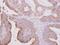 Tubulin Beta 2A Class IIa antibody, PA5-27552, Invitrogen Antibodies, Immunohistochemistry paraffin image 