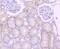Cathepsin L antibody, NBP2-67216, Novus Biologicals, Immunohistochemistry paraffin image 