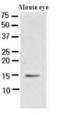 Cellular Retinoic Acid Binding Protein 1 antibody, GTX85889, GeneTex, Western Blot image 