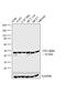 Casein Kinase 2 Alpha 1 antibody, PA5-17534, Invitrogen Antibodies, Western Blot image 